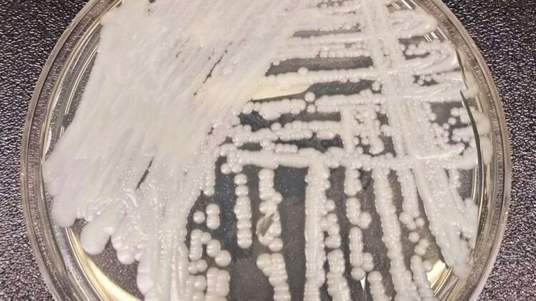 Candida auris, il fungo che mette alla prova la sanità 2