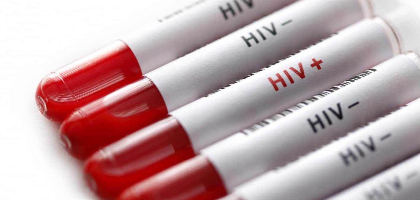 Uganda, legge anti-omosessualità nega le cure contro l'HIV 2