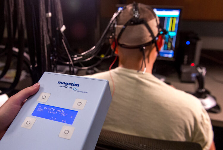 La tDCS potrebbe bloccare la progressione dell’Alzheimer 2