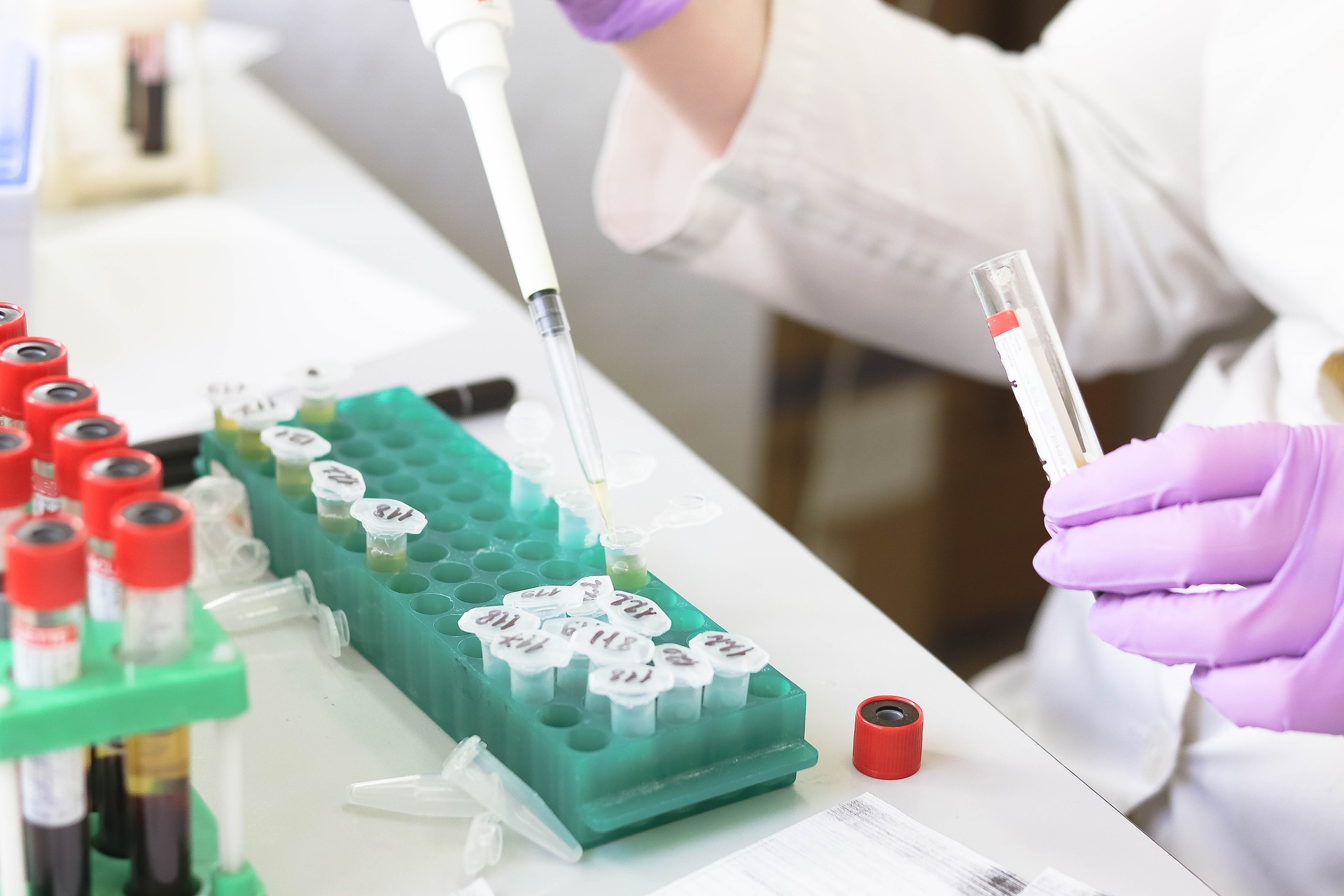 Sindrome di Dravet, cerotto genetico come nuova terapia 2