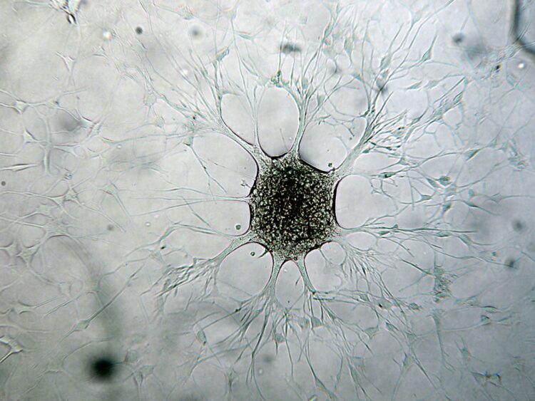 Metastasi come un processo caotico? Non è esattamente così 2