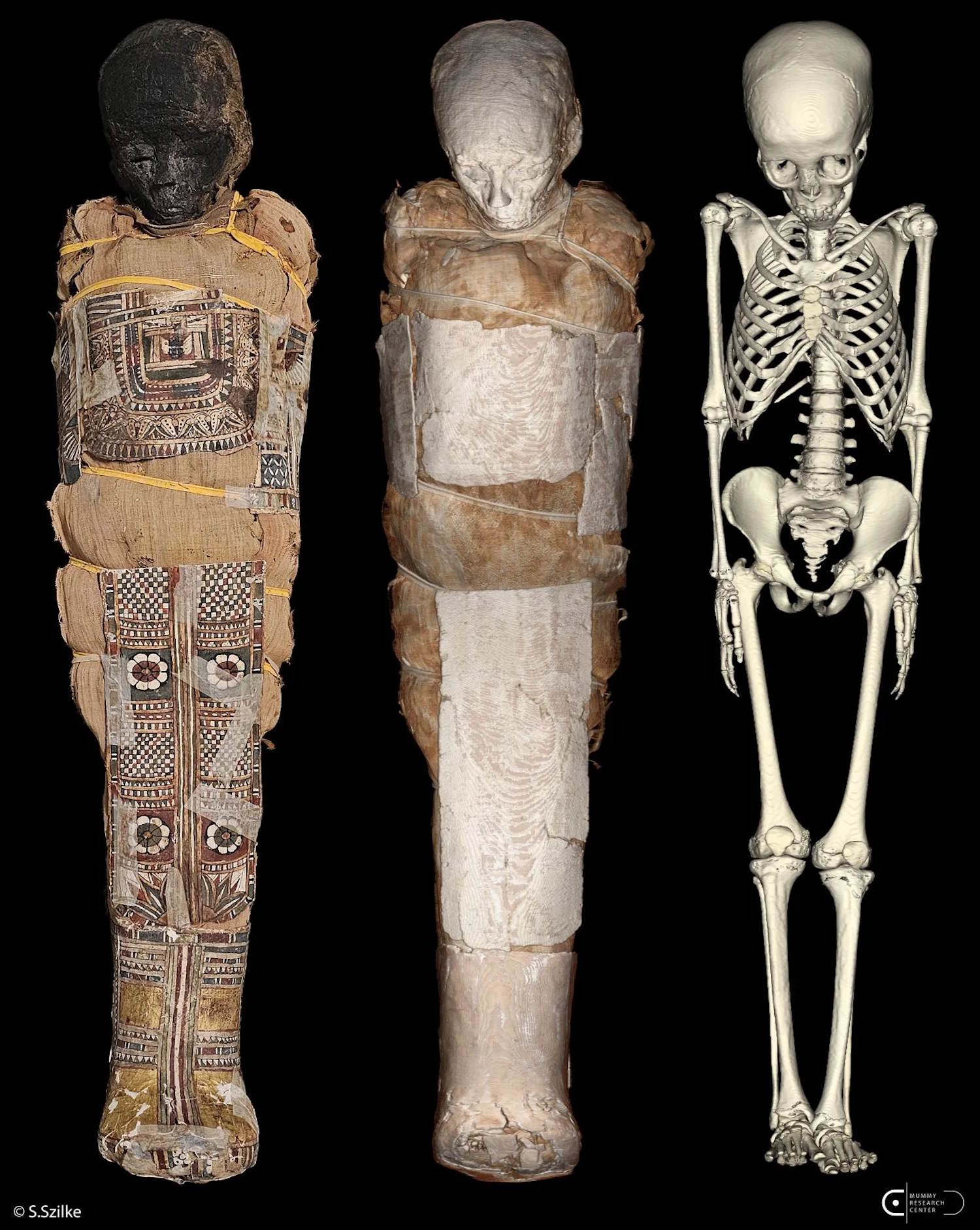 Un enigmatico papiro potrebbe trovarsi sotto il torace di una mummia di un giovane egiziano dell'antichità. 3