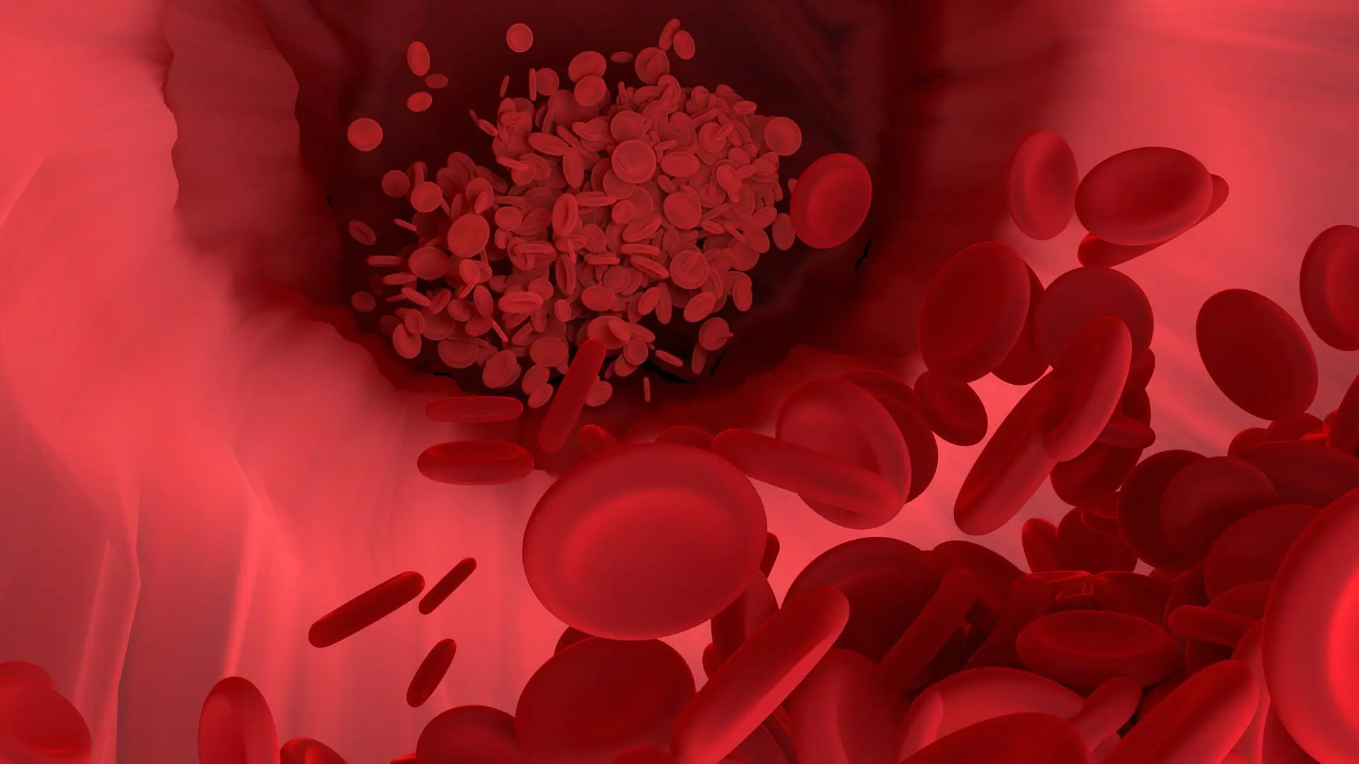 Nanoplastiche nel sangue coronarico, un nuovo studio 2